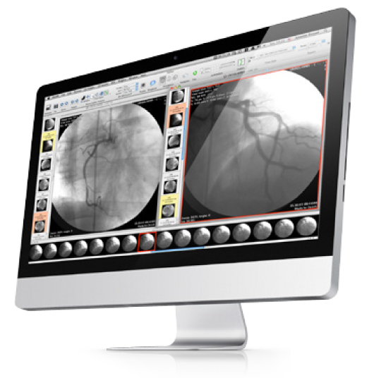 osirix lite launch with different local database
