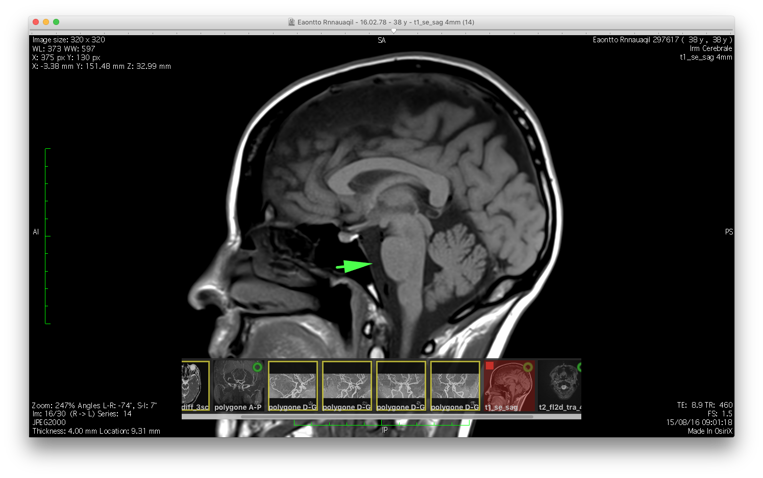 Osirix free download for pc