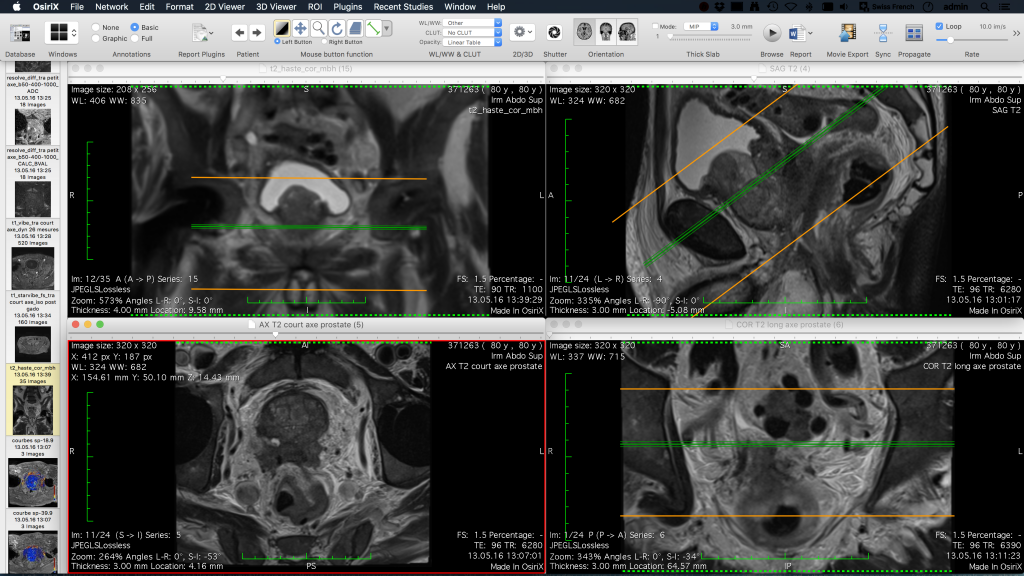 osirix lite launch with different local database