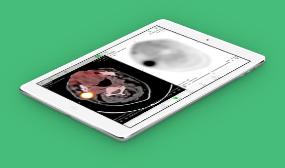 osirix md version too many devices